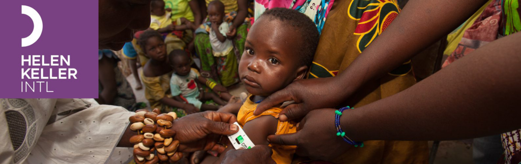 Un enfant Africain voit son bras mesuré par le personnel d'Helen Keller International afin de déterminer son niveau de développement.