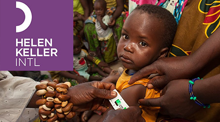 Un enfant Africain voit son bras mesuré par le personnel d'Helen Keller International afin de déterminer son niveau de développement.