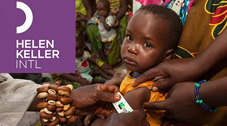 Un enfant voit son bras mesuré par un membre de Hellen Keller pour évaluer son niveau de nutrition. Logo dans le coin supérieur gauche.